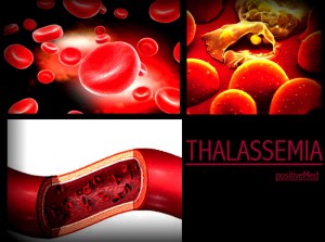 thalassemia